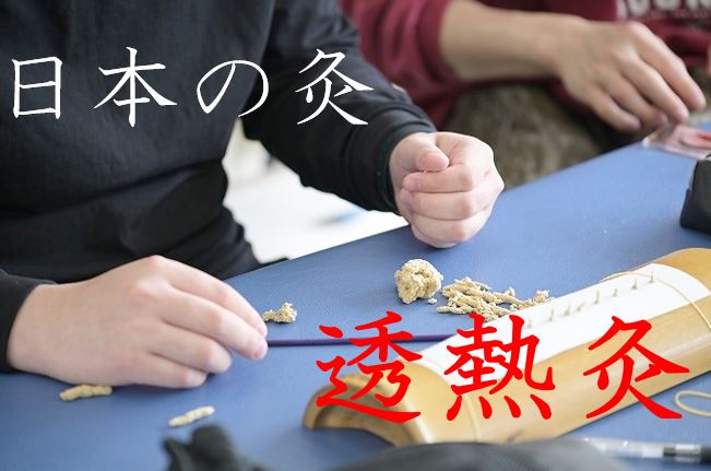 【東洋ブログ 大希のつぶやき】日本鍼灸 透熱灸（点灸）始まりました