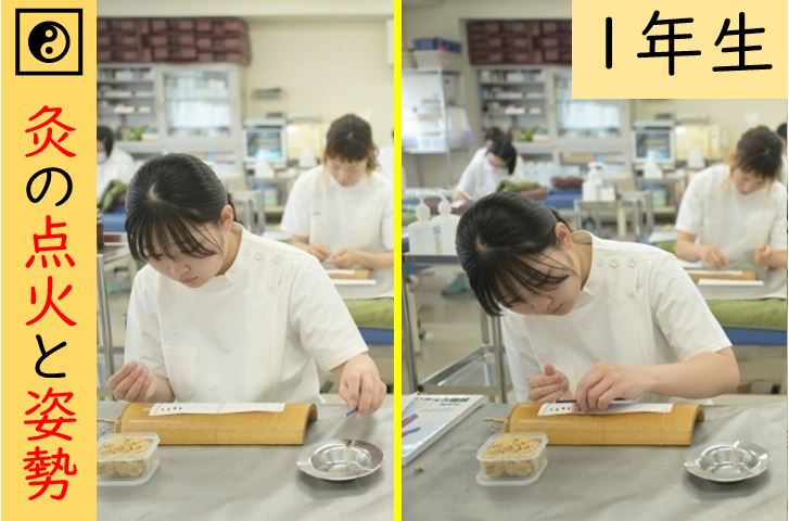 【東洋ブログ 大希のつぶやき】 灸の点火と姿勢